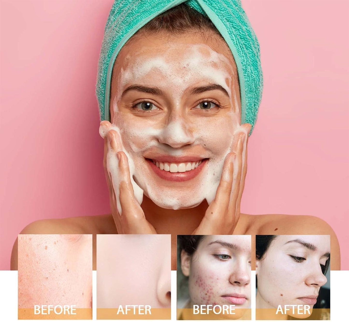 Turmeric Facial Cleanser, 2PCS Turmeric Facial Wash, Turmeric Foaming Cleanser for All Skin, Turmeric Kojic Acid Foaming Cleanser, Yellow